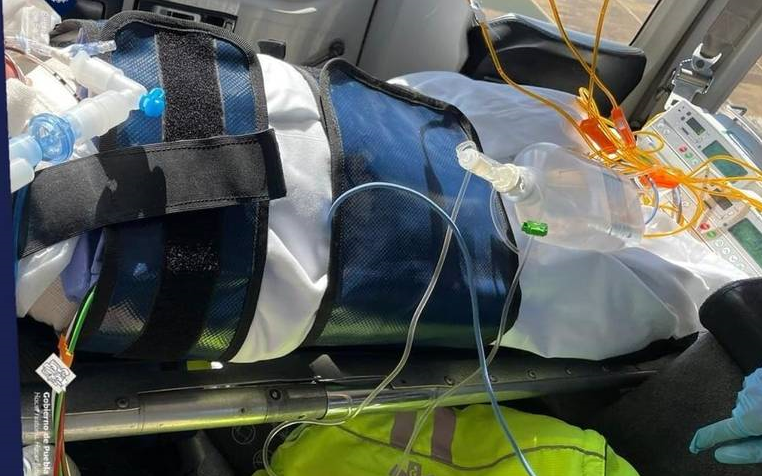 Cae niño de dos años a una cubeta de manteca hirviendo en Tepeaca