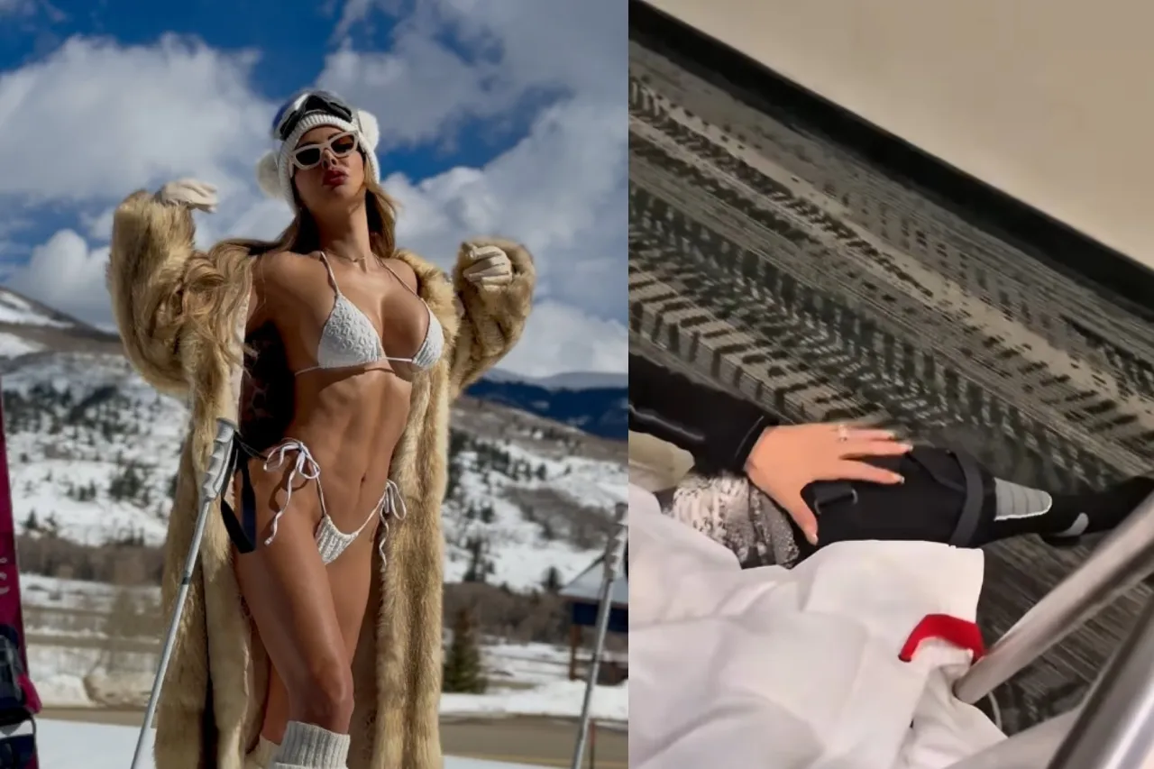 Ninel Conde sufre accidente y queda sin poder caminar