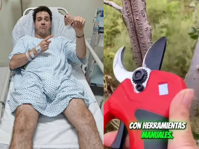 “Me partió el hueso en dos”: Jimmy de Pongámoslo a Prueba sufre grave accidente probando producto